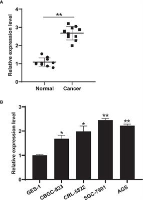 CircHIPK3 Promotes the Tumorigenesis and Development of Gastric Cancer Through miR-637/AKT1 Pathway